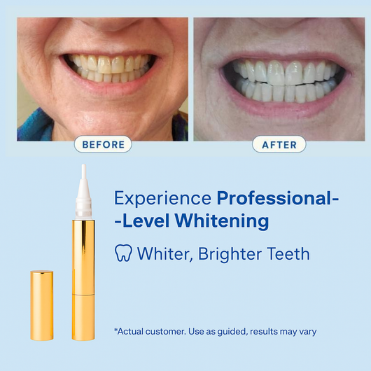 Teeth Whitening Serum