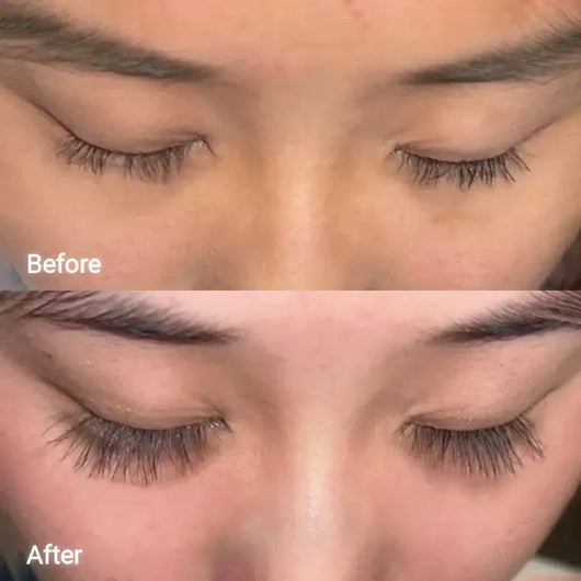 Eyelash Growth Serum