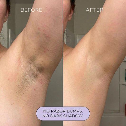 Hair Removal Spray