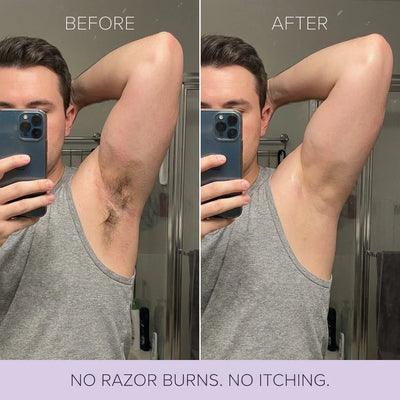 Hair Removal Spray
